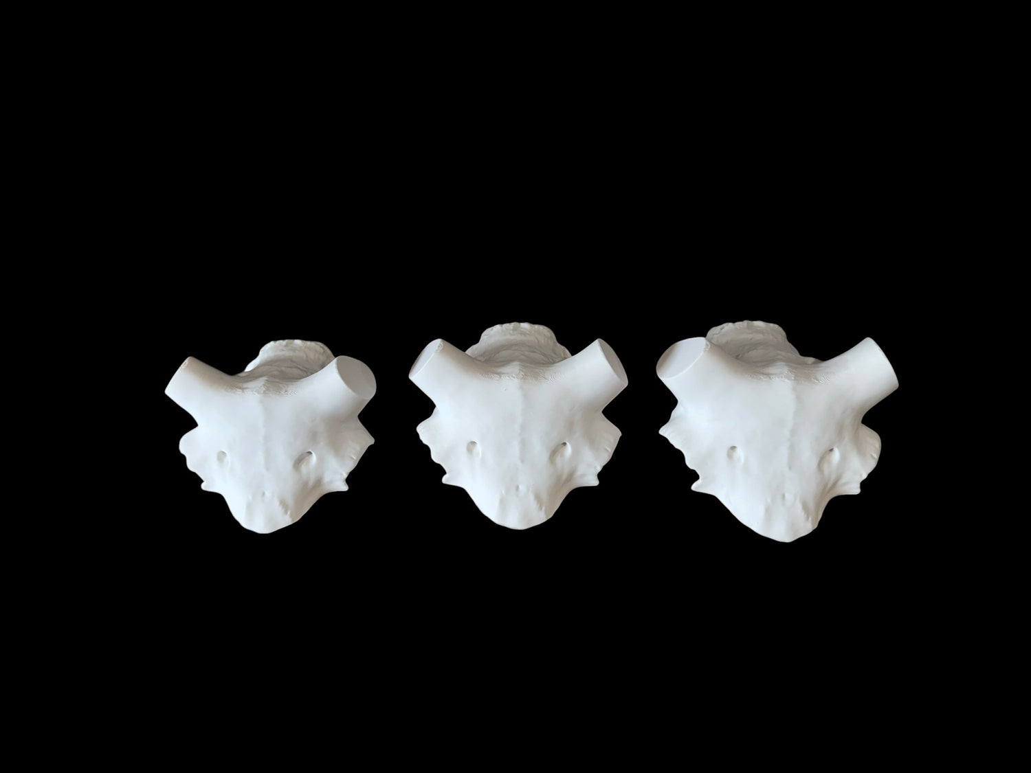 Ram Skull Caps